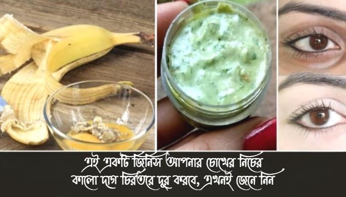 এই-একটি-জিনিস-আপনার-চোখের-নিচের-কালো-দাগ-চিরতরে-দূর-করবে-এখনই-জেনে-নিন.